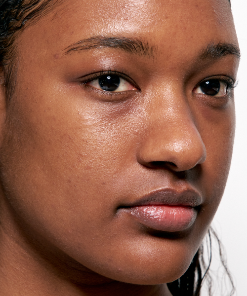 Close-up of woman's face before treatment