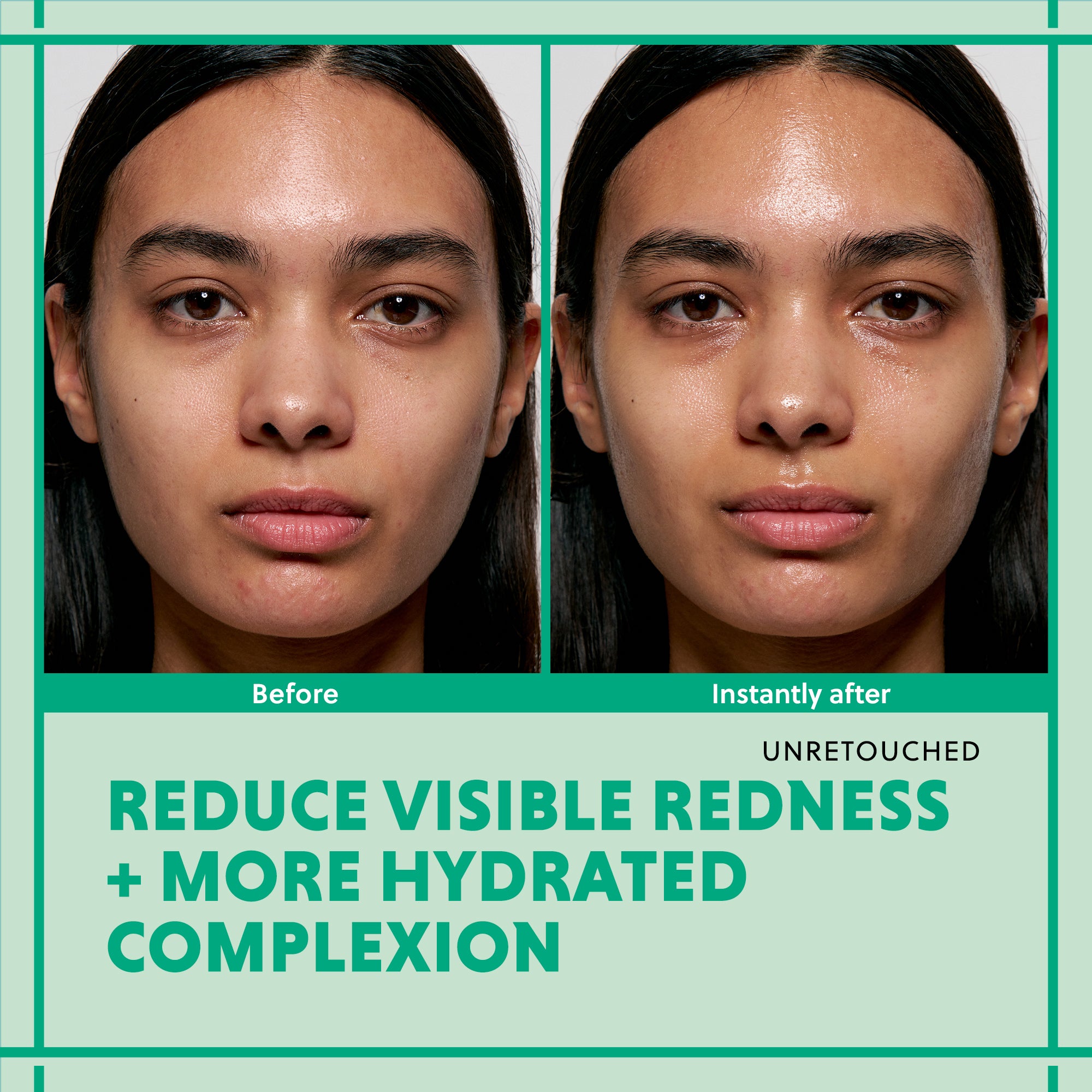 Side-by-side comparison showing reduced redness and enhanced hydration, unretouched model photos.