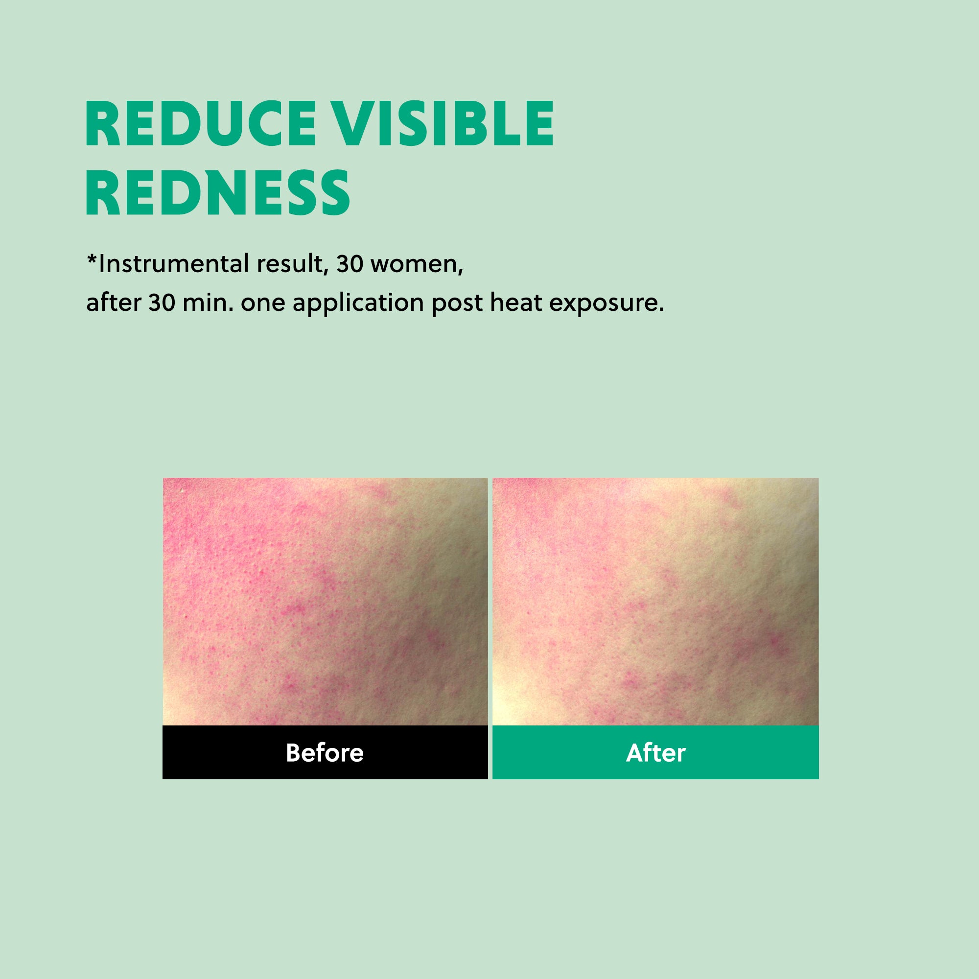 Skin test result image showing visible redness before and after use.