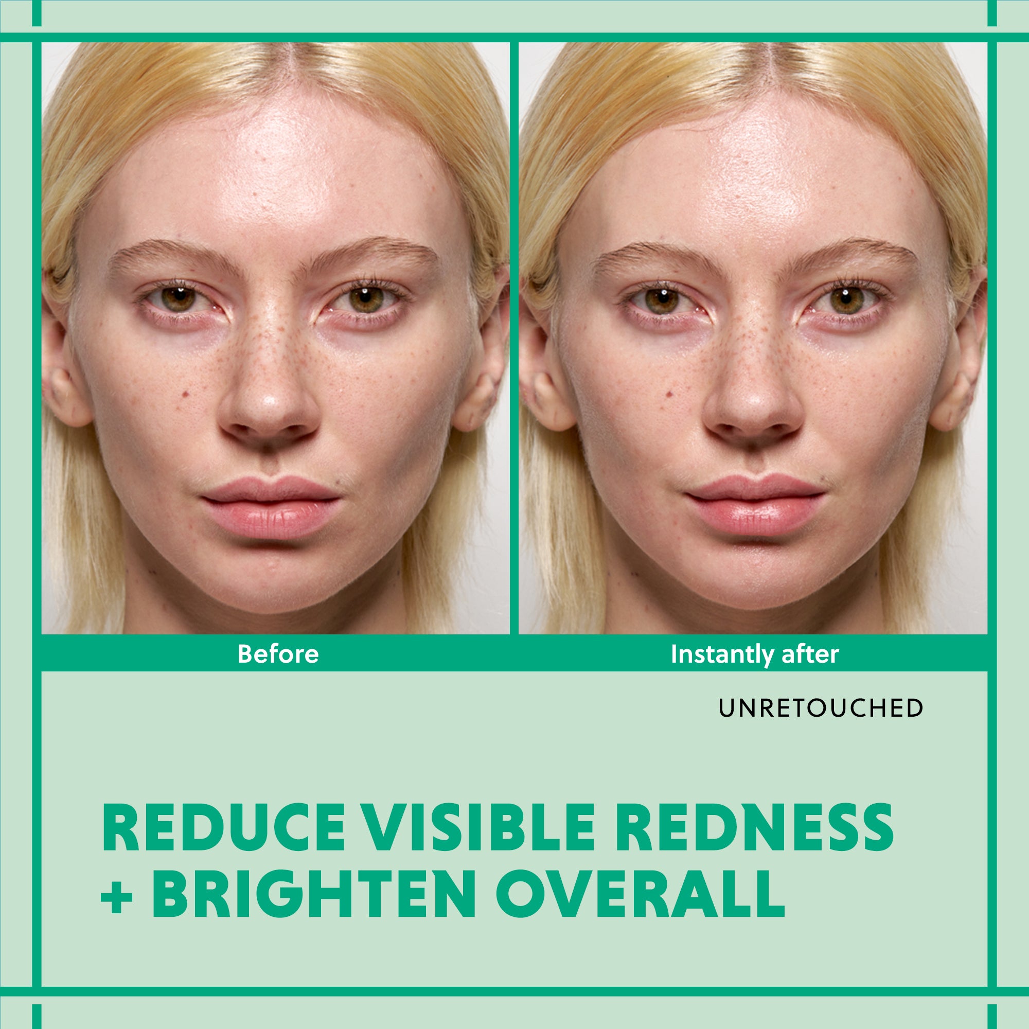 Before and after comparison showing reduced redness and brighter skin, unretouched for realism.
